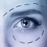oculoplastia
