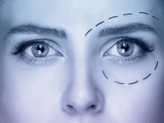 oculoplastia