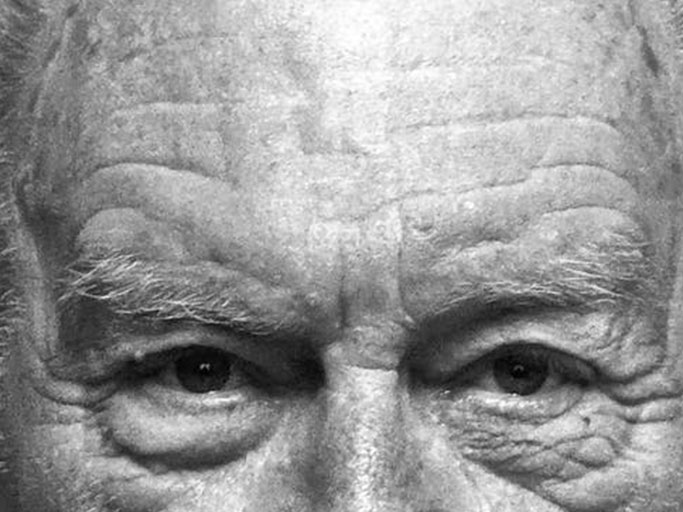 oculoplastia