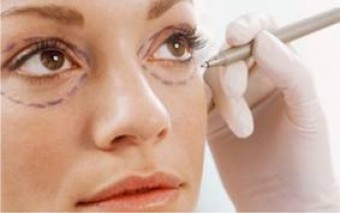 oculoplastia