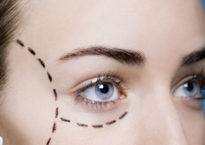 oculoplastia