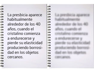 presbicia